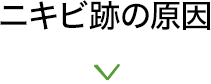 ニキビ跡の原因