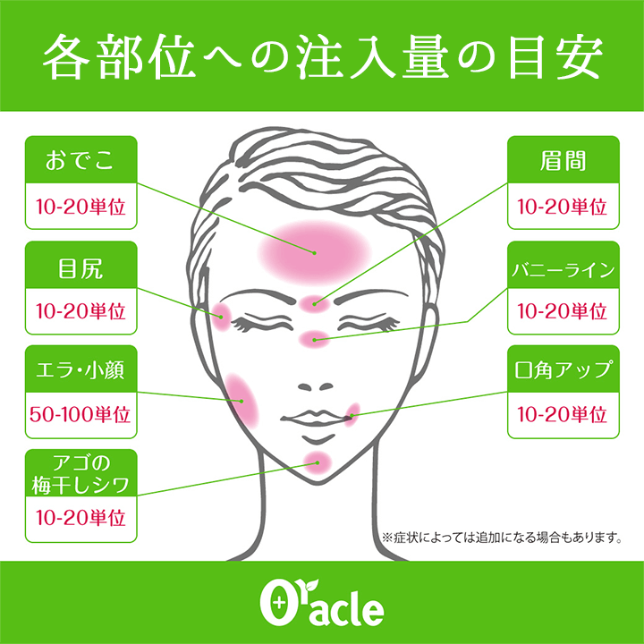 おでこ・眉間・目尻・バニーライン・口角アップ・アゴの梅干しシワは10-20単位。エラ・小顔は50-100単位