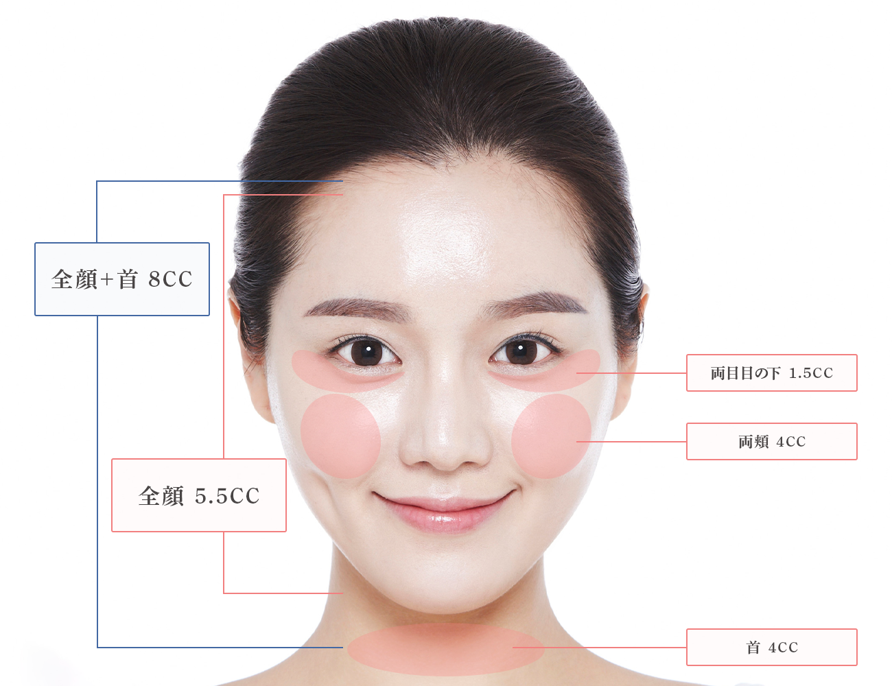 リジュラン注射の各部位注入量の目安です