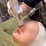 4、施術