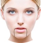 マリオネットライン