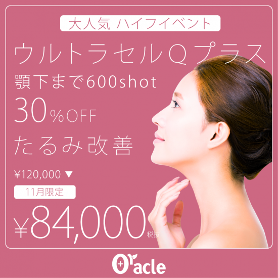 11月CP 大人気ハイフイベント