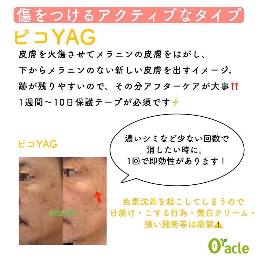 timeline_20220825_134214