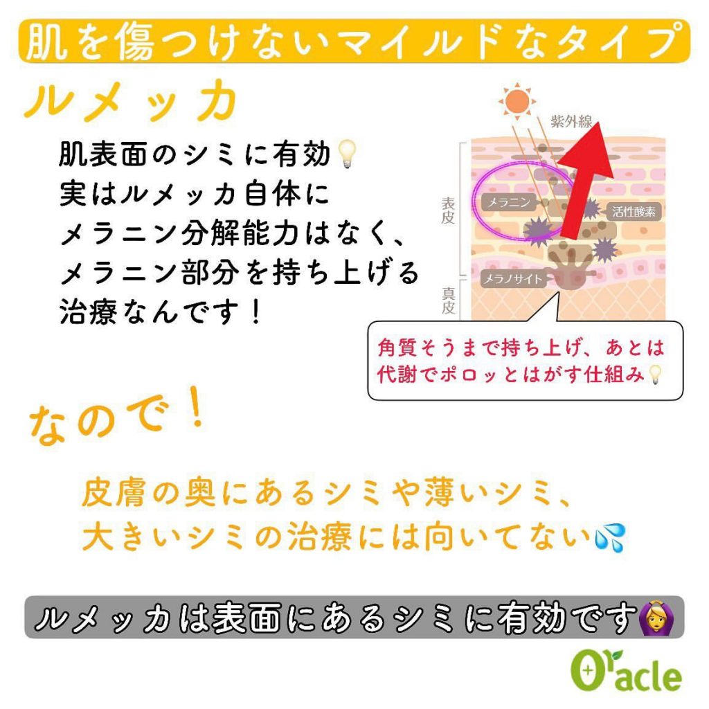 timeline_20220825_134215_0